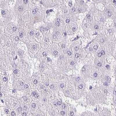 Immunohistochemistry-Paraffin: TPPP/p25 Antibody [NBP1-80962]