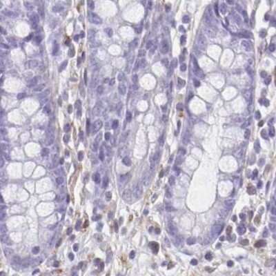 Immunohistochemistry-Paraffin: TPPP/p25 Antibody [NBP1-80962]