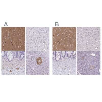 Immunohistochemistry-Paraffin: TPPP/p25 Antibody [NBP1-80962]