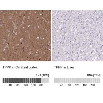 Immunohistochemistry-Paraffin: TPPP/p25 Antibody [NBP1-80962]
