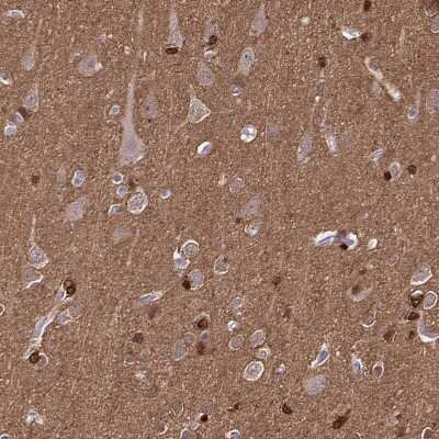 Immunohistochemistry-Paraffin: TPPP/p25 Antibody [NBP1-80962]