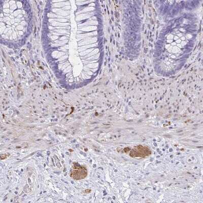 Immunohistochemistry-Paraffin: TPPP/p25 Antibody [NBP1-80962]