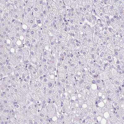 Immunohistochemistry-Paraffin: TPPP/p25 Antibody [NBP1-80962]