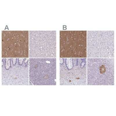 Immunohistochemistry-Paraffin: TPPP/p25 Antibody [NBP2-34031]