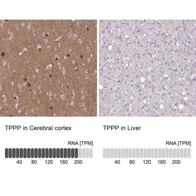 Immunohistochemistry-Paraffin: TPPP/p25 Antibody [NBP2-34031]