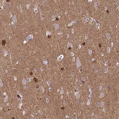 Immunohistochemistry-Paraffin: TPPP/p25 Antibody [NBP2-34031]