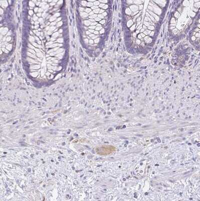 Immunohistochemistry-Paraffin: TPPP/p25 Antibody [NBP2-34031]