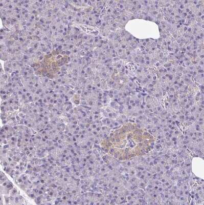 Immunohistochemistry-Paraffin: TPPP/p25 Antibody [NBP2-34031]