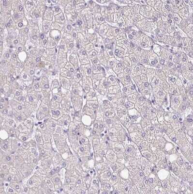 Immunohistochemistry-Paraffin: TPPP/p25 Antibody [NBP2-34031]
