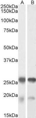 Western Blot: TPPP/p25 Antibody [NBP1-49833]