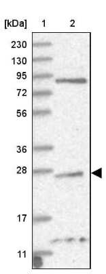 Western Blot: TPPP/p25 Antibody [NBP1-80962]