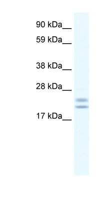 Western Blot: TPPP/p25 Antibody [NBP1-91613]