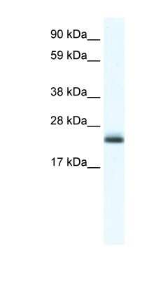 Western Blot: TPPP/p25 Antibody [NBP1-91614]