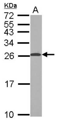 Western Blot: TPPP/p25 Antibody [NBP2-20688]