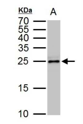 Western Blot: TPPP/p25 Antibody [NBP2-20688]