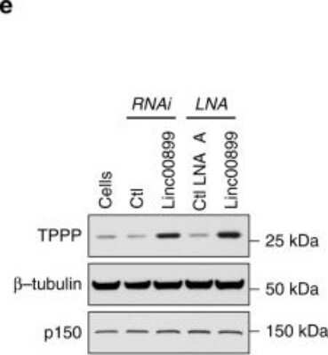 Western Blot: TPPP/p25 Antibody [NBP2-34031]