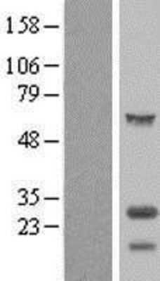 Western Blot: TPPP/p25 Overexpression Lysate [NBP2-10387]