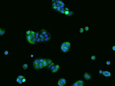 Immunocytochemistry/ Immunofluorescence: TPPP2 Antibody [NBP2-97873]