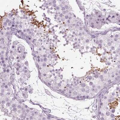Immunohistochemistry-Paraffin: TPPP2 Antibody [NBP1-88430]
