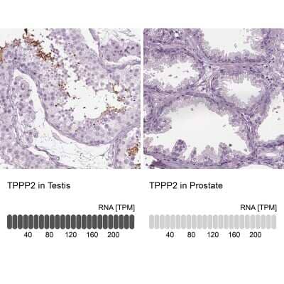 Immunohistochemistry-Paraffin: TPPP2 Antibody [NBP1-88430]