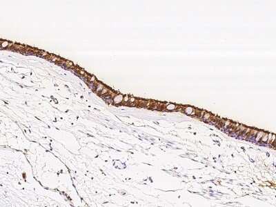 Immunohistochemistry-Paraffin: TPPP2 Antibody [NBP2-97873]