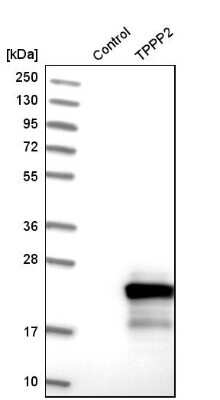 Western Blot: TPPP2 Antibody [NBP1-88430]