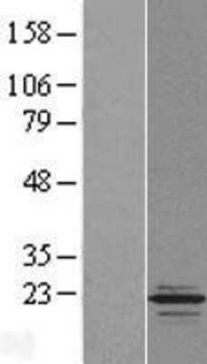 Western Blot: TPPP2 Overexpression Lysate [NBL1-17225]