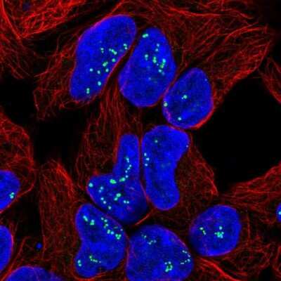 Immunocytochemistry/ Immunofluorescence: TPPP3 Antibody [NBP2-13469]