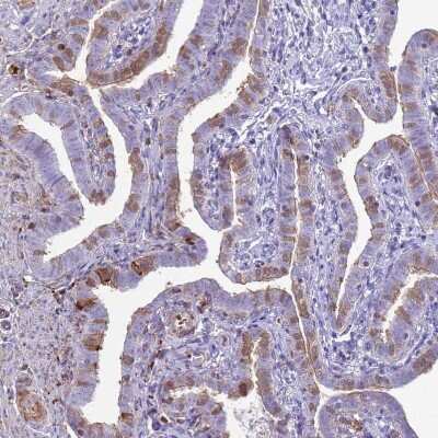 Immunohistochemistry-Paraffin: TPPP3 Antibody [NBP2-13469]