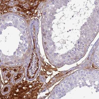 Immunohistochemistry-Paraffin: TPPP3 Antibody [NBP2-13469]
