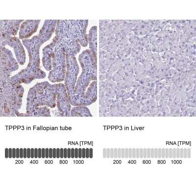 Immunohistochemistry-Paraffin: TPPP3 Antibody [NBP2-13469]