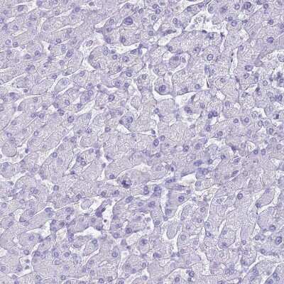 Immunohistochemistry-Paraffin: TPPP3 Antibody [NBP2-13469]