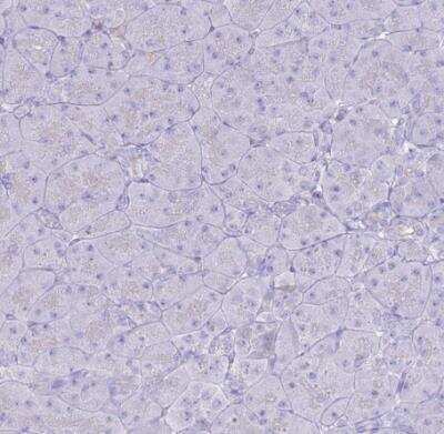 Immunohistochemistry-Paraffin: TPPP3 Antibody [NBP2-13469]