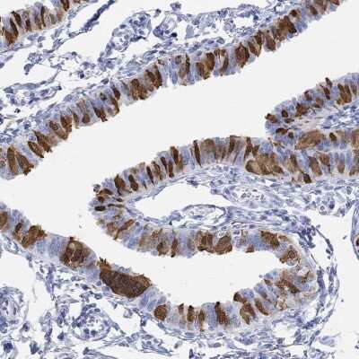 Immunohistochemistry-Paraffin: TPPP3 Antibody [NBP3-17045]