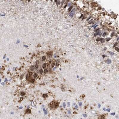 Immunohistochemistry-Paraffin: TPPP3 Antibody [NBP3-17045]