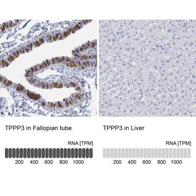 Immunohistochemistry-Paraffin: TPPP3 Antibody [NBP3-17045]