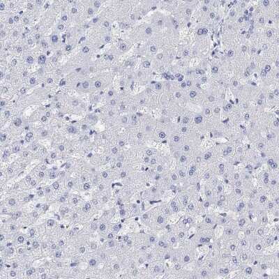 Immunohistochemistry-Paraffin: TPPP3 Antibody [NBP3-17045]