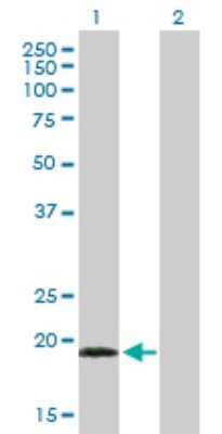 Western Blot: TPPP3 Antibody [H00051673-B02P]