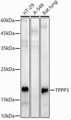 Western Blot: TPPP3 AntibodyAzide and BSA Free [NBP2-95209]