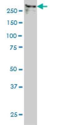 Western Blot: TPR Antibody (1A8) [H00007175-M01]