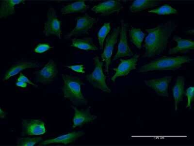 Immunocytochemistry/ Immunofluorescence: TPR Antibody (1F8) [H00007175-M05]