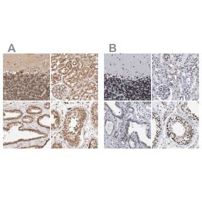 Immunohistochemistry-Paraffin: TPR Antibody [NBP1-89448]