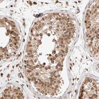 Immunohistochemistry-Paraffin: TPR Antibody [NBP1-89448]