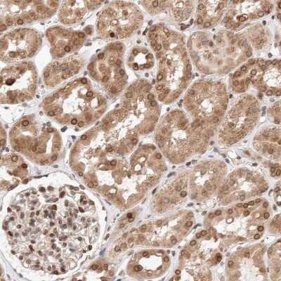 Immunohistochemistry-Paraffin: TPR Antibody [NBP1-89448]