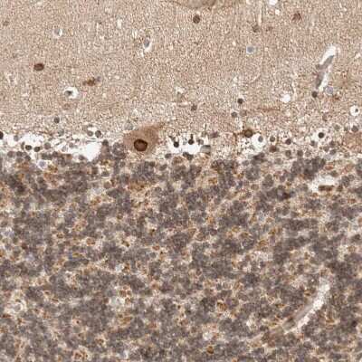 Immunohistochemistry-Paraffin: TPR Antibody [NBP1-89448]