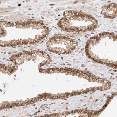 Immunohistochemistry-Paraffin: TPR Antibody [NBP1-89448]