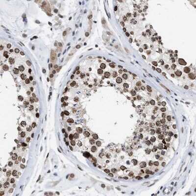 Immunohistochemistry-Paraffin: TPR Antibody [NBP1-89452]