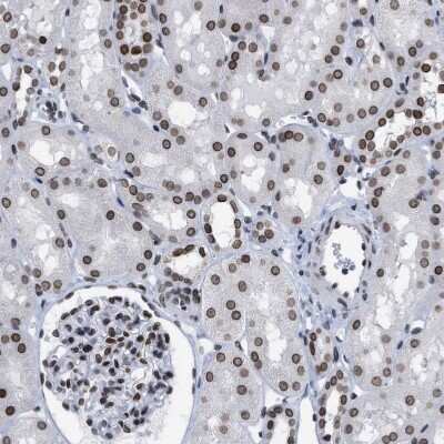 Immunohistochemistry-Paraffin: TPR Antibody [NBP1-89452]