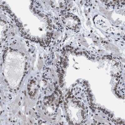 Immunohistochemistry-Paraffin: TPR Antibody [NBP1-89452]
