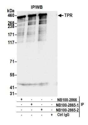 Immunoprecipitation: TPR Antibody [NB100-2865]